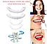 Накладные/съемные декоративные виниры для зубов Snap-On Smile 2шт. (Верх+Низ), фото 8