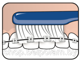 Зубная щетка ТеРе Implant Ortho - фото 2 - id-p39518067
