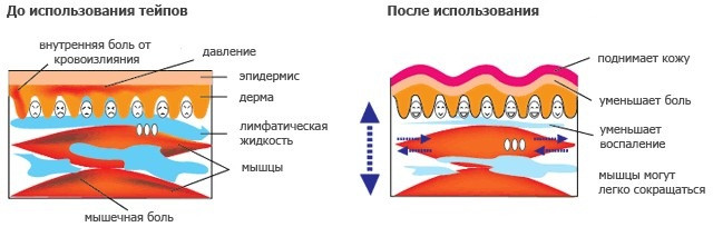 Кинезио тейп усиленный, 7.5см*5м, BBTape MAX, бежевый - фото 5 - id-p62714289