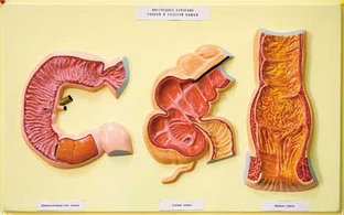 В19 Рельефная модель «Внутренняя поверхность тонкой и толстой кишки», Медиус (Россия) 