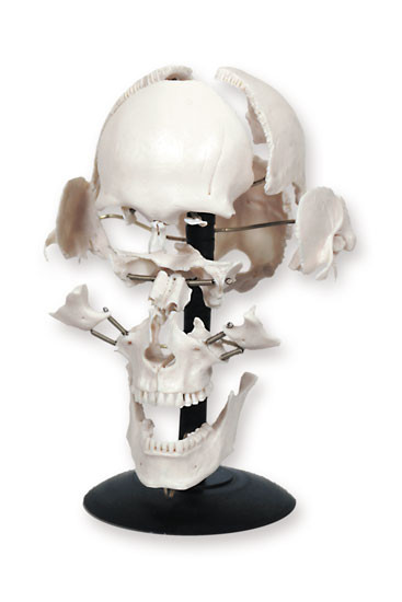 P6 Череп с разрозненными костями (смонтиpованный на подставке), Медиус (Россия) 