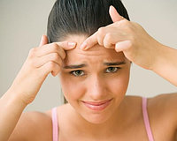 ACNE легкой степени