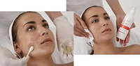 ACNE средней степени